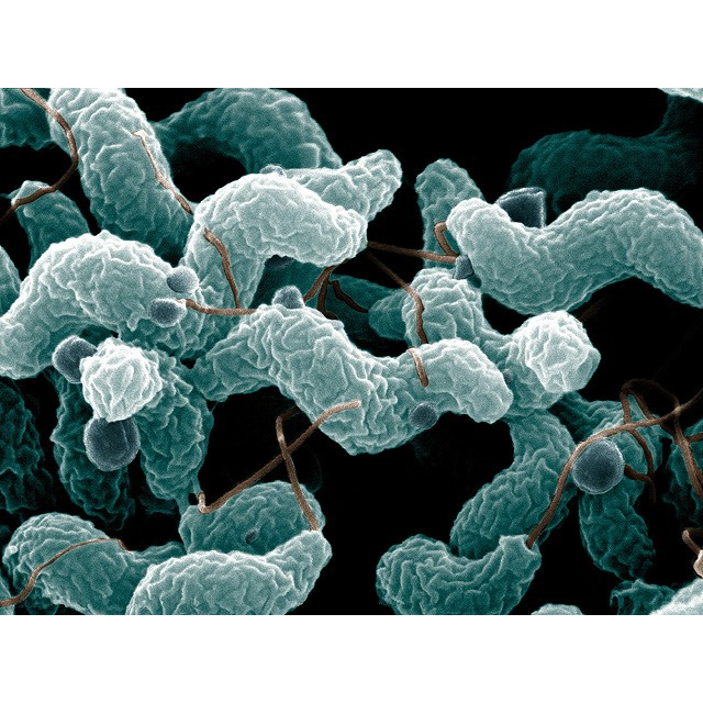 Mikroskopi av Campylobacter-bakterien.   Photo by De Wood; digital colorization by Chris Pooley. Link